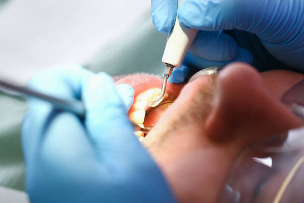 Best Emergency Broken Tooth Repair in Tariffville, CT